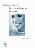 The Science Porcelain Laminate Vaneers